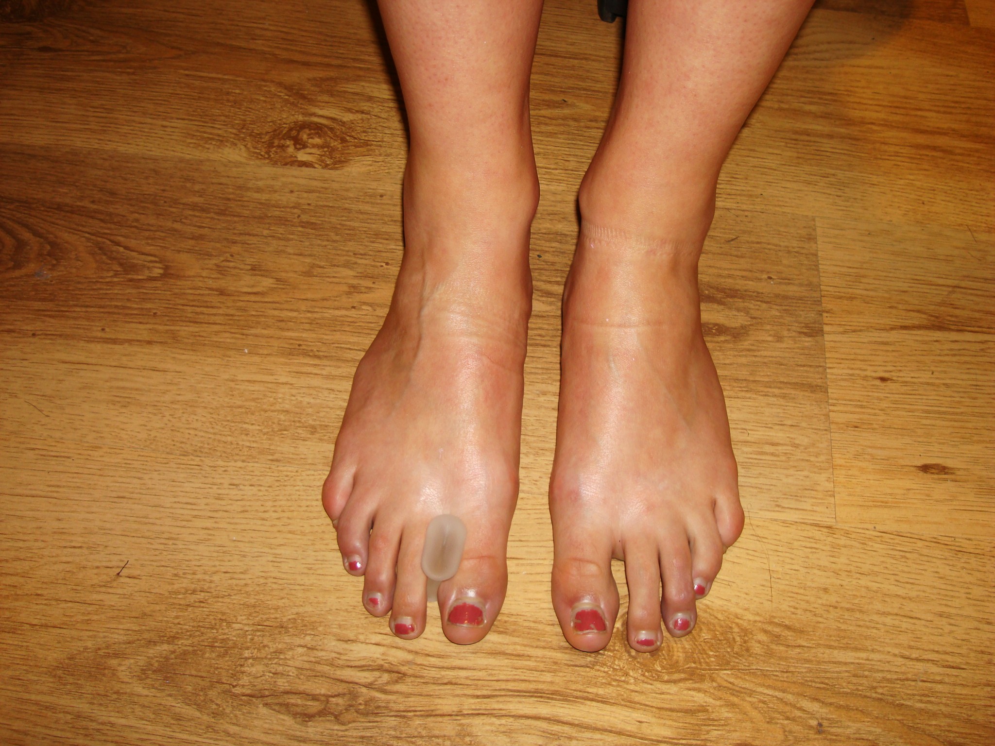 ballet toe